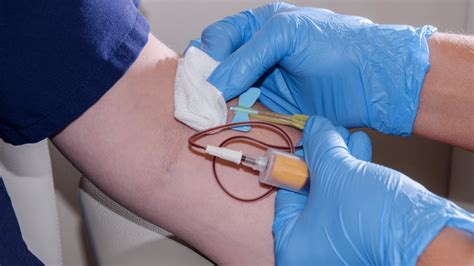 6 Steps To The Ultimate Blood Draw Today