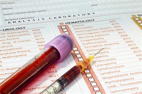 6 Ultimate Tips To Make The Hepatitis C Antibody Blood Test Today