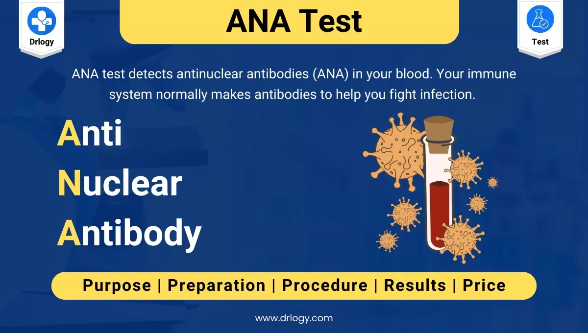 Ana Test Ana Test Positive Antinuclear Anti Body Test Procedure