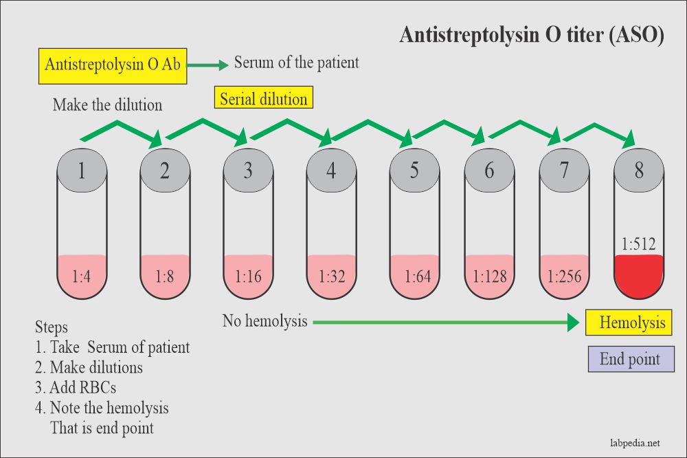 Anti Streptolysin O Titer Aso Purpose Normal Range Of Results 1Mg