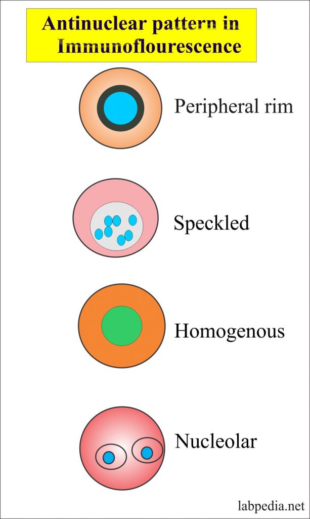 Antinuclear Antibody Ana Titers Download Scientific Diagram