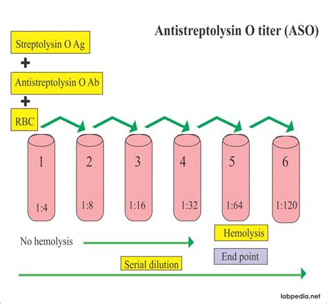 Antistreptolysin O Aso Titer Test Mbbch Health Encyclopedia