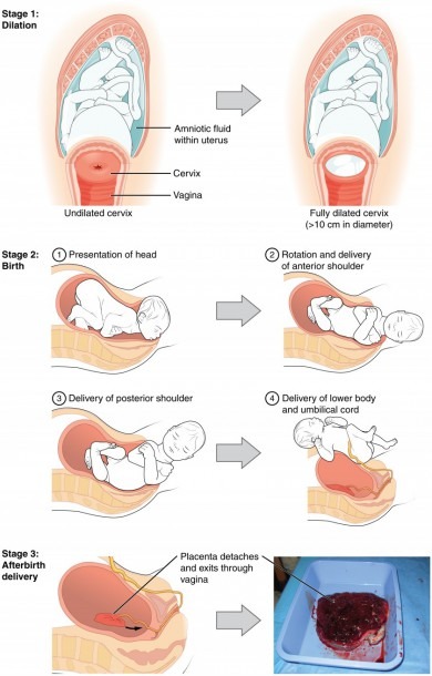 Can Checking Cervix Induce Labor