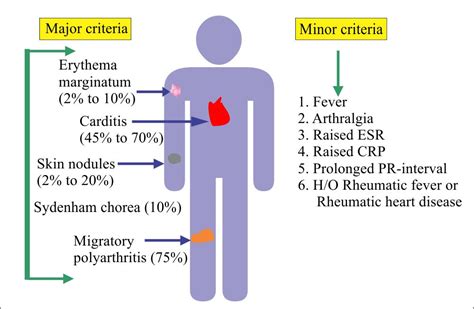 Chapter 25 Autoimmune Diseases Rheumatic Fever Labpedia Net