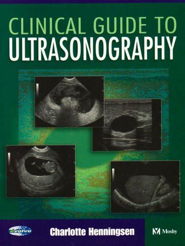 Clinical Guide To Sonography By Henningsen Ms Rt American Book Warehouse