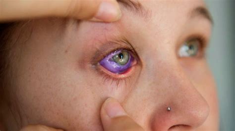 Eyeball Tattoos The New Form Of Extreme Body Modification That Is