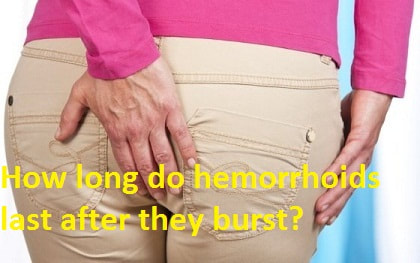 How Long Do Hemorrhoids Last After They Burst How Long Do