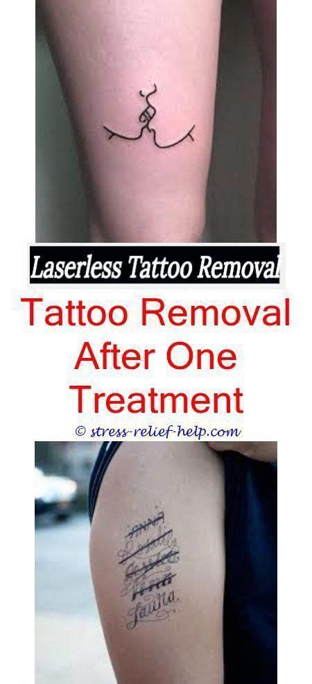 How To Remove Permanent Tattoo