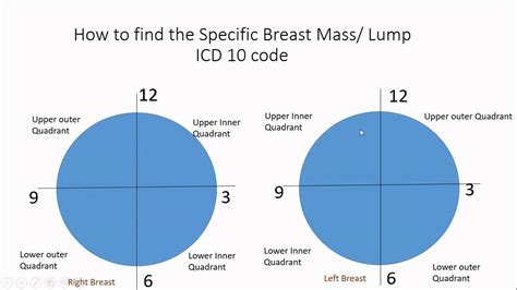 Icd 10 Coding Guide For Breast Mass Lump N63 Series Youtube