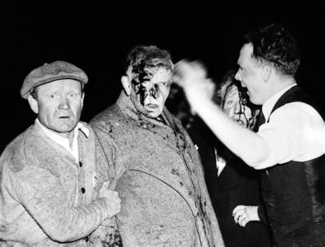 Injured In The Hindenburg Crash Survivors Are Dazed And Bloodied By