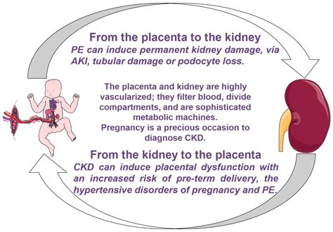 Jcm Free Full Text Pregnancy And Kidney Diseases Multidisciplinary