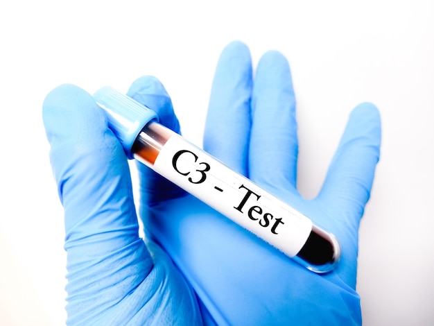 C3 C4 Blood Test - Military and Veteran Benefits