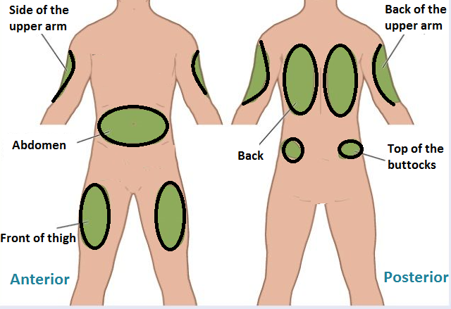 Subcutaneous Injection Sites Names