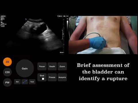 Ultrasound Tutorial Fast Focused Assessment With Sonography For