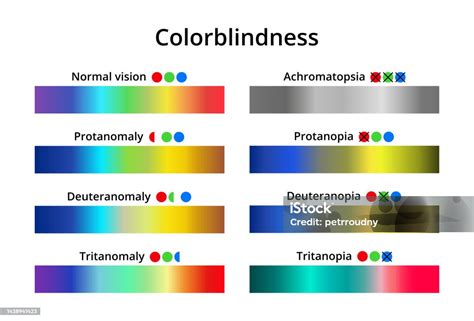 Vector Illustration Of Color Blindness Or Colorblindness Normal Vision Achromatopsia Protanomaly